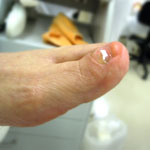 爪のケア施術の様子