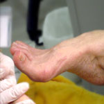 正しい靴の履き方によるトラブル予防